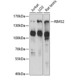Western Blot - Anti-RIM2 Antibody (A88429) - Antibodies.com