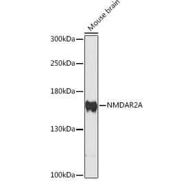 Western Blot - Anti-NMDAR2A Antibody (A88430) - Antibodies.com