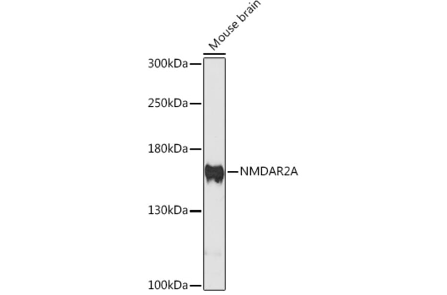 Western Blot - Anti-NMDAR2A Antibody (A88430) - Antibodies.com