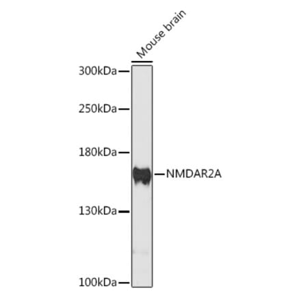 Western Blot - Anti-NMDAR2A Antibody (A88430) - Antibodies.com