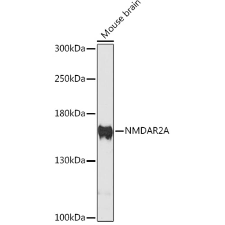 Western Blot - Anti-NMDAR2A Antibody (A88430) - Antibodies.com