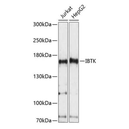 Western Blot - Anti-IBTK Antibody (A88432) - Antibodies.com