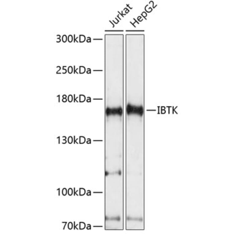 Western Blot - Anti-IBTK Antibody (A88432) - Antibodies.com
