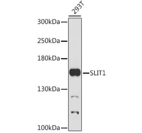 Western Blot - Anti-Slit1 Antibody (A88433) - Antibodies.com