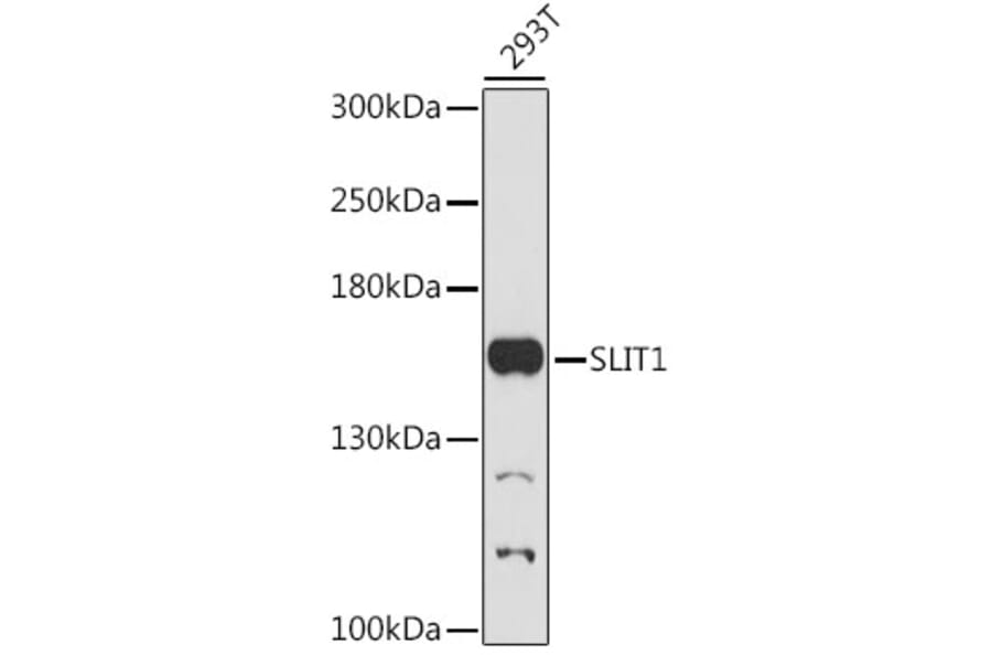 Western Blot - Anti-Slit1 Antibody (A88433) - Antibodies.com