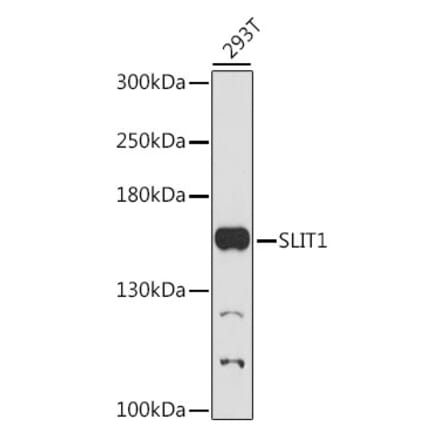 Western Blot - Anti-Slit1 Antibody (A88433) - Antibodies.com