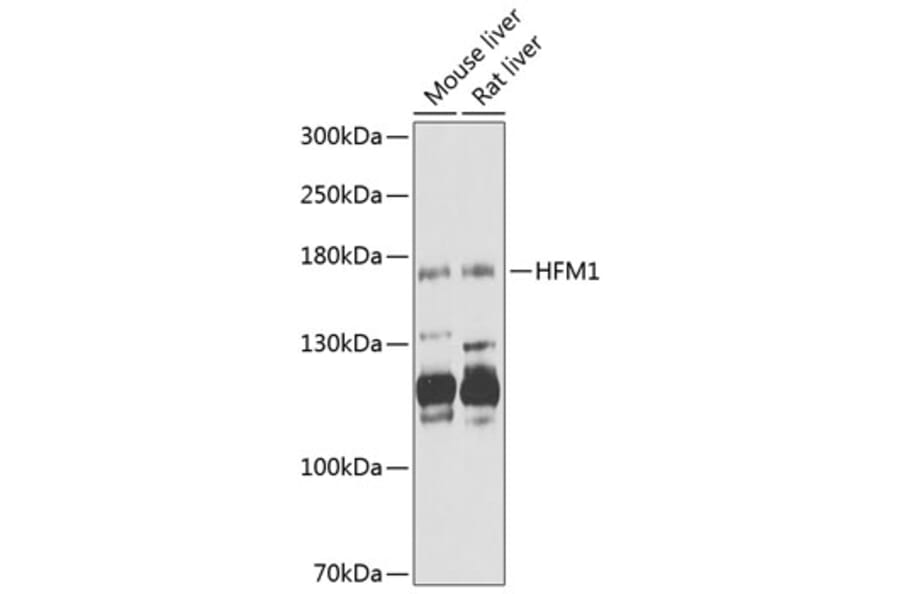 Western Blot - Anti-HFM1 Antibody (A12614) - Antibodies.com