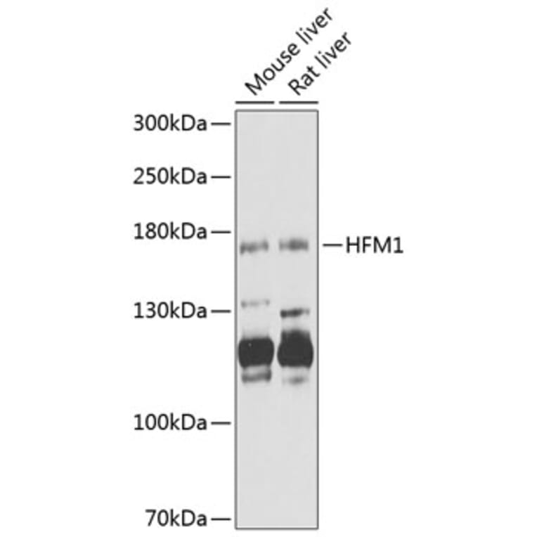 Western Blot - Anti-HFM1 Antibody (A12614) - Antibodies.com