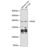 Western Blot - Anti-HFM1 Antibody (A12614) - Antibodies.com