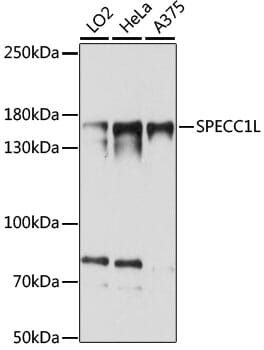 Western blot analysis of extracts of various cell lines, using Anti-SPECC1L Antibody (A15798) at 1:1,000 dilution.
Secondary antibody: Goat Anti-Rabbit IgG (H+L) (HRP) (AS014) at 1:10,000 dilution.
Lysates / proteins: 25µg per lane.
Blocking buffer: 3% non-fat dry milk in TBST.
Detection: ECL Basic Kit (RM00020).
Exposure time: 15s.