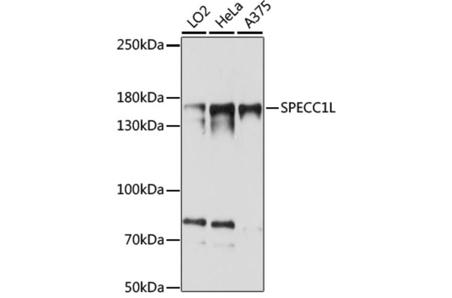 Western Blot - Anti-SPECC1L Antibody (A88435) - Antibodies.com