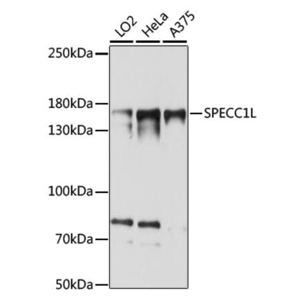 Western Blot - Anti-SPECC1L Antibody (A88435) - Antibodies.com