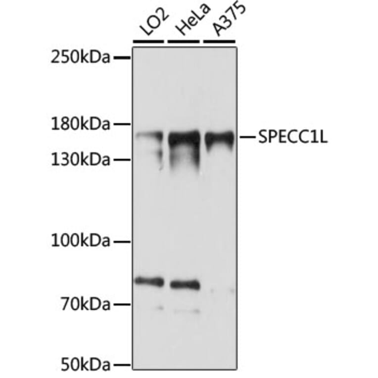 Western Blot - Anti-SPECC1L Antibody (A88435) - Antibodies.com