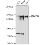 Western Blot - Anti-SPECC1L Antibody (A88435) - Antibodies.com