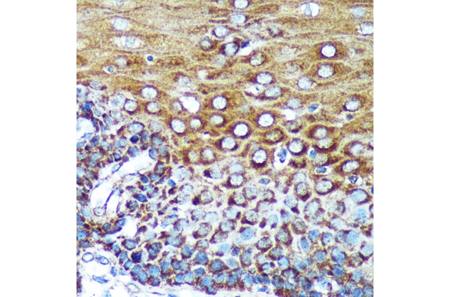 Immunohistochemistry - Anti-SPECC1L Antibody (A88435) - Antibodies.com