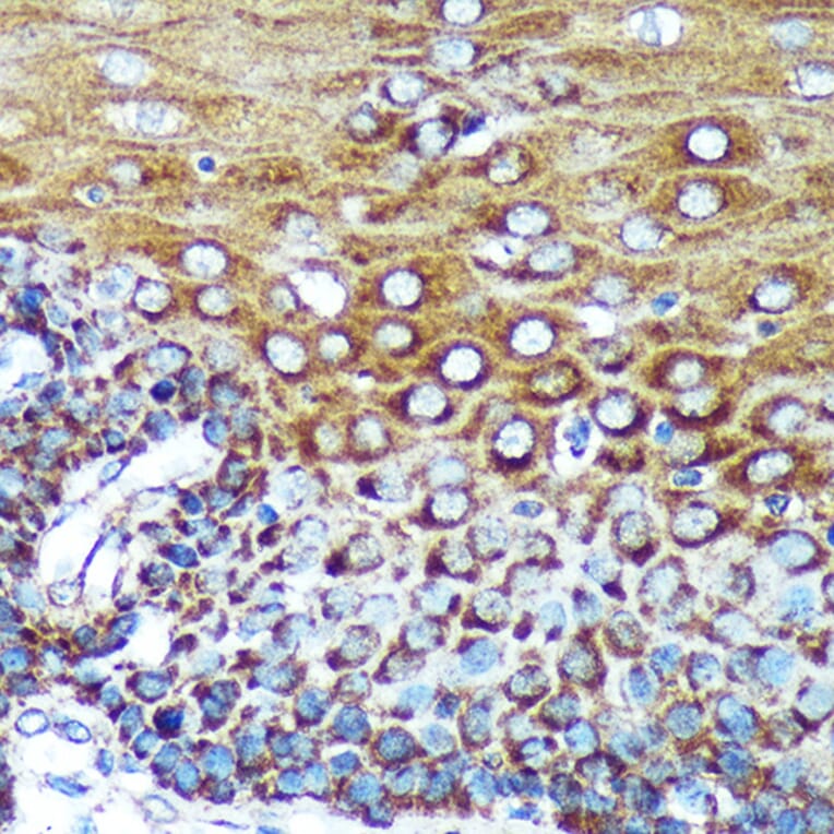 Immunohistochemistry - Anti-SPECC1L Antibody (A88435) - Antibodies.com