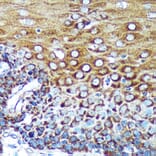 Immunohistochemistry - Anti-SPECC1L Antibody (A88435) - Antibodies.com