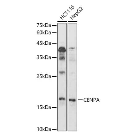 Western Blot - Anti-CENPA Antibody (A88437) - Antibodies.com