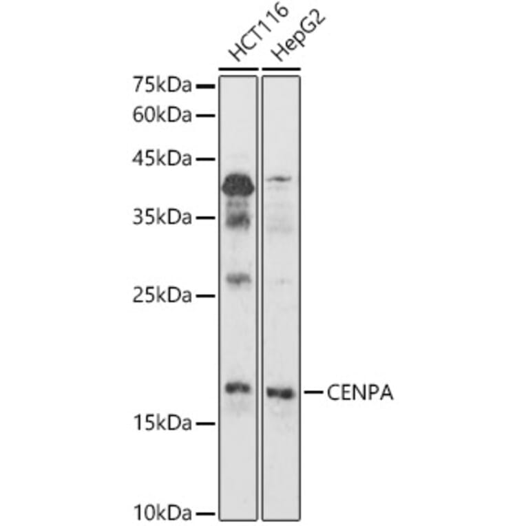 Western Blot - Anti-CENPA Antibody (A88437) - Antibodies.com