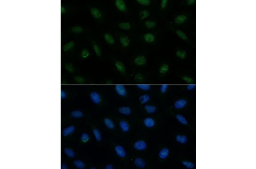 Immunofluorescence - Anti-CENPA Antibody (A88437) - Antibodies.com