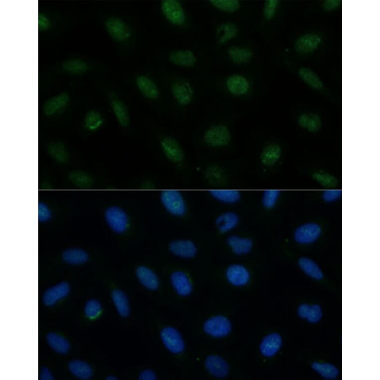 Immunofluorescence - Anti-CENPA Antibody (A88437) - Antibodies.com