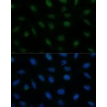 Immunofluorescence - Anti-CENPA Antibody (A88437) - Antibodies.com