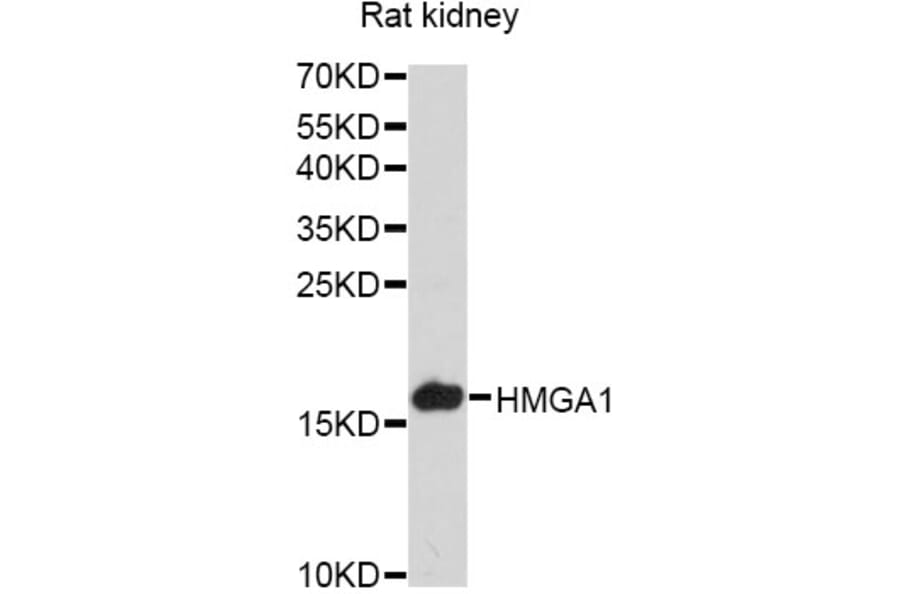 Western Blot - Anti-HMGA1 Antibody (A12693) - Antibodies.com