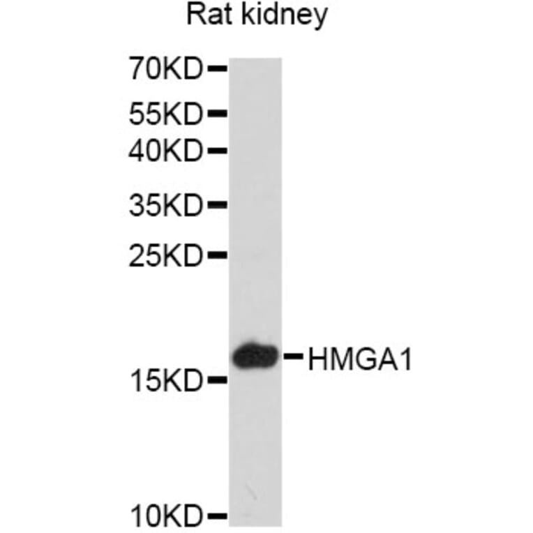 Western Blot - Anti-HMGA1 Antibody (A12693) - Antibodies.com