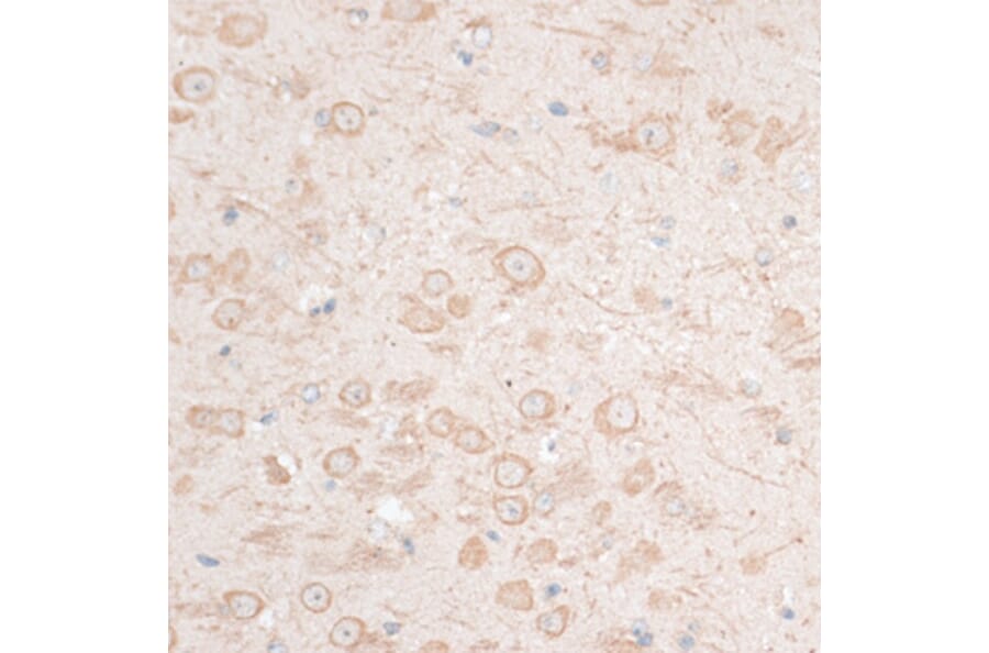 Immunohistochemistry - Anti-HMGA1 Antibody (A12693) - Antibodies.com