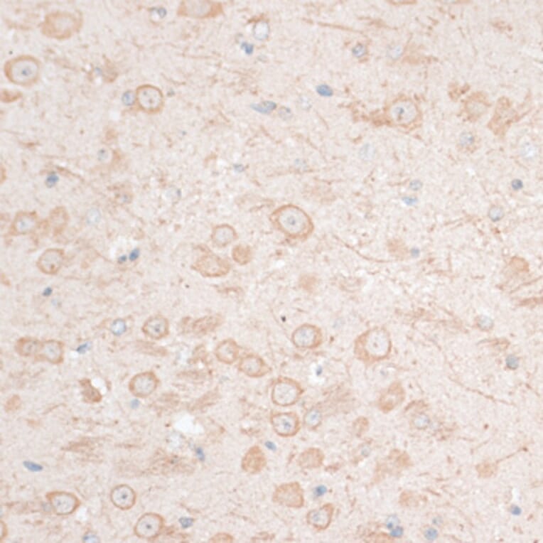 Immunohistochemistry - Anti-HMGA1 Antibody (A12693) - Antibodies.com