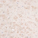 Immunohistochemistry - Anti-HMGA1 Antibody (A12693) - Antibodies.com