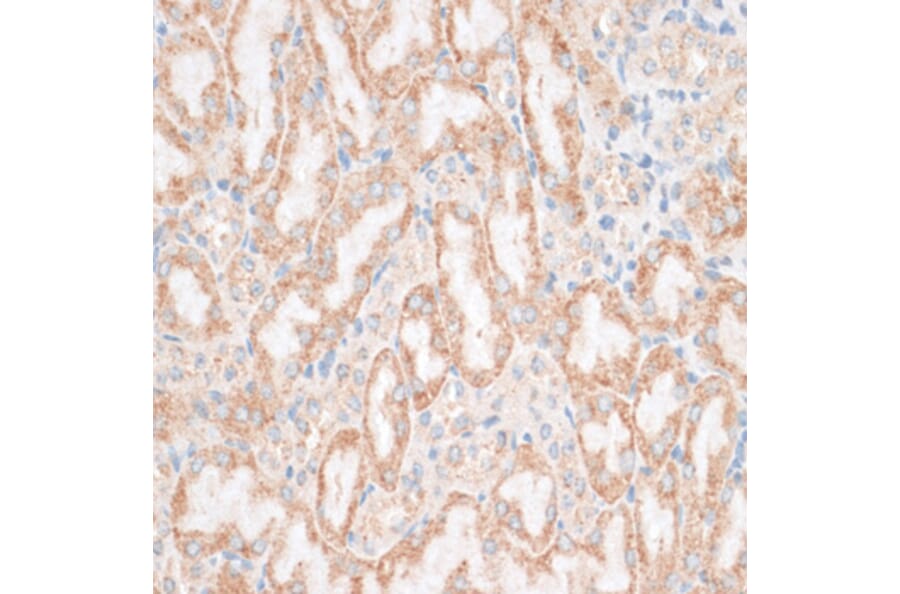 Immunohistochemistry - Anti-HMGA1 Antibody (A12693) - Antibodies.com