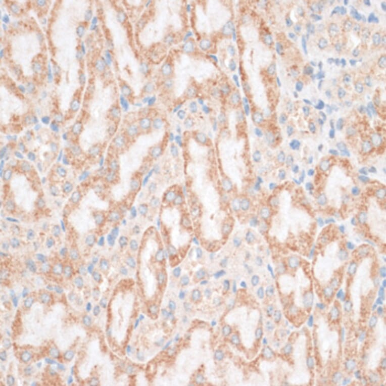 Immunohistochemistry - Anti-HMGA1 Antibody (A12693) - Antibodies.com