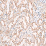 Immunohistochemistry - Anti-HMGA1 Antibody (A12693) - Antibodies.com