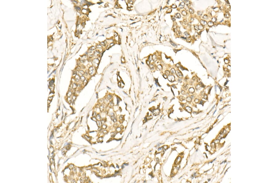 Immunohistochemistry - Anti-LC3B Antibody (A88439) - Antibodies.com