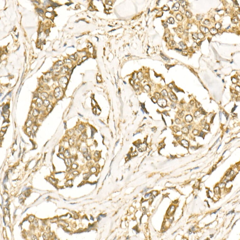 Immunohistochemistry - Anti-LC3B Antibody (A88439) - Antibodies.com