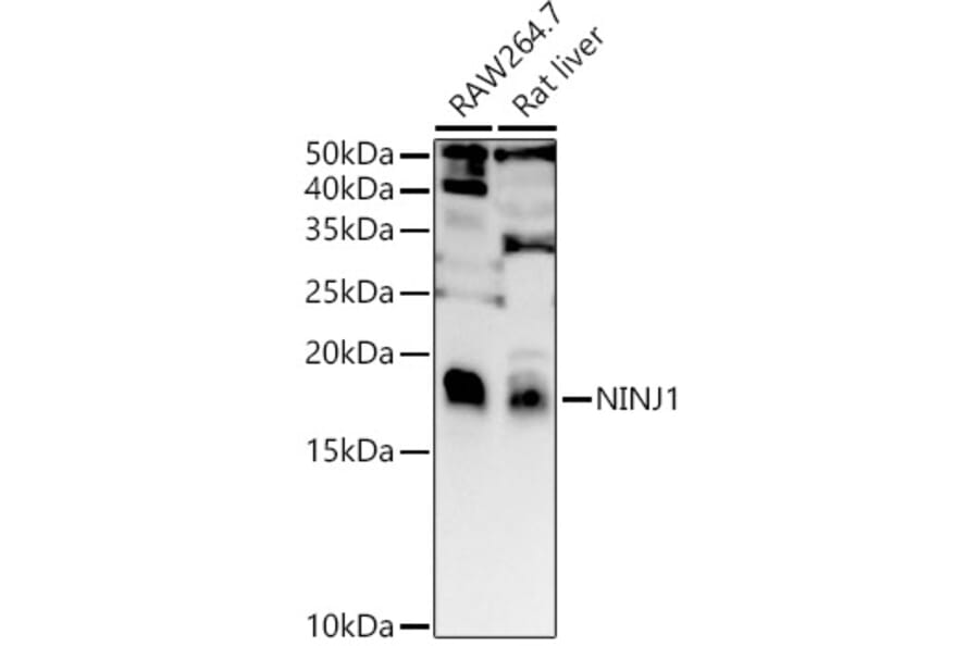 Western Blot - Anti-Ninjurin 1 Antibody (A88440) - Antibodies.com