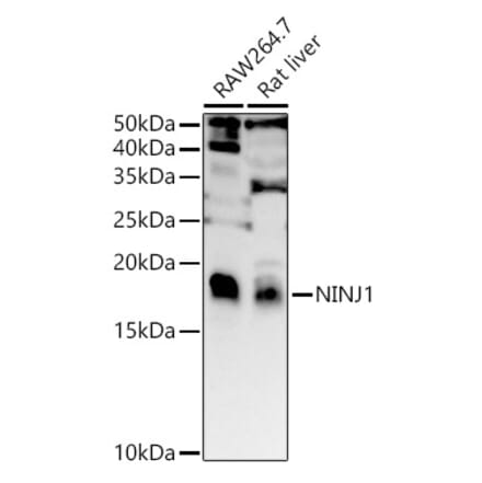 Western Blot - Anti-Ninjurin 1 Antibody (A88440) - Antibodies.com