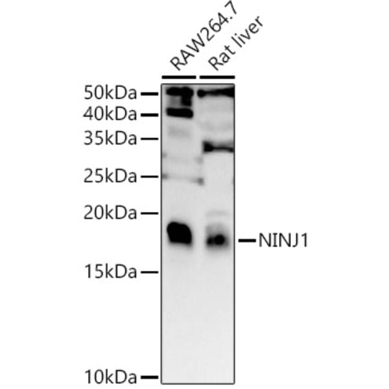 Western Blot - Anti-Ninjurin 1 Antibody (A88440) - Antibodies.com