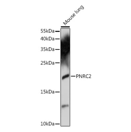 Western Blot - Anti-PNRC2 Antibody (A88441) - Antibodies.com