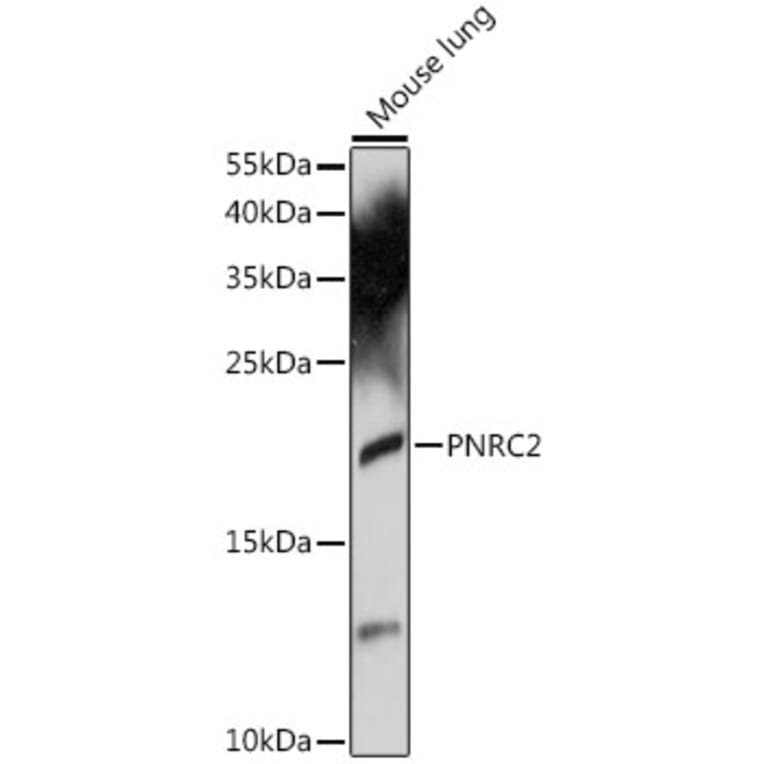 Western Blot - Anti-PNRC2 Antibody (A88441) - Antibodies.com