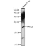 Western Blot - Anti-PNRC2 Antibody (A88441) - Antibodies.com