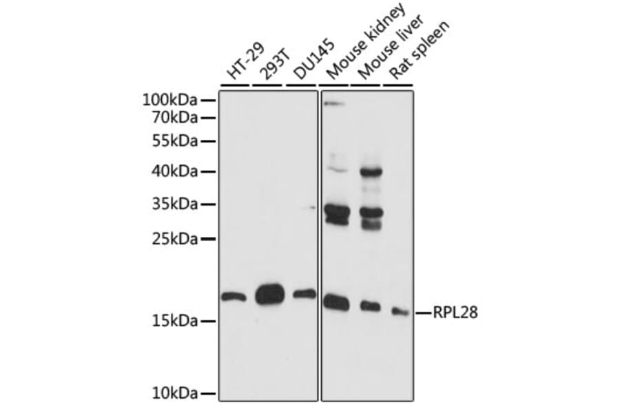 Western Blot - Anti-RPL28 Antibody (A88442) - Antibodies.com