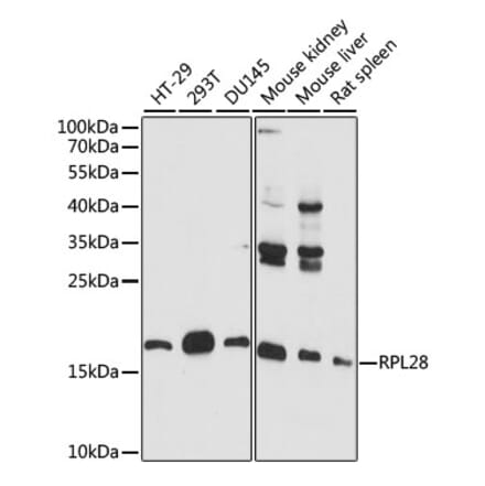 Western Blot - Anti-RPL28 Antibody (A88442) - Antibodies.com