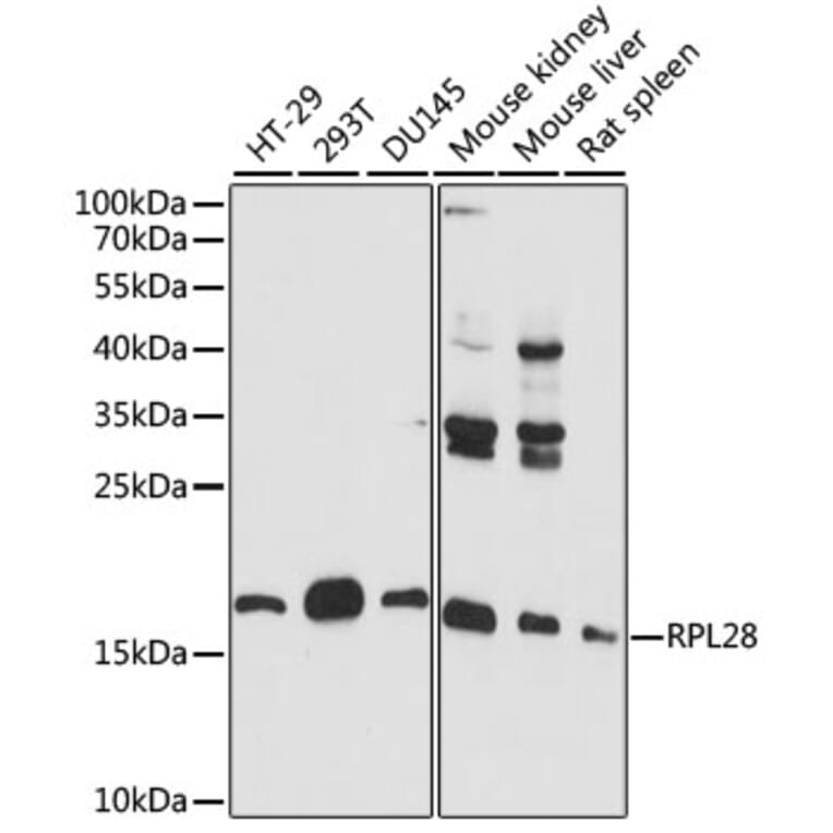 Western Blot - Anti-RPL28 Antibody (A88442) - Antibodies.com