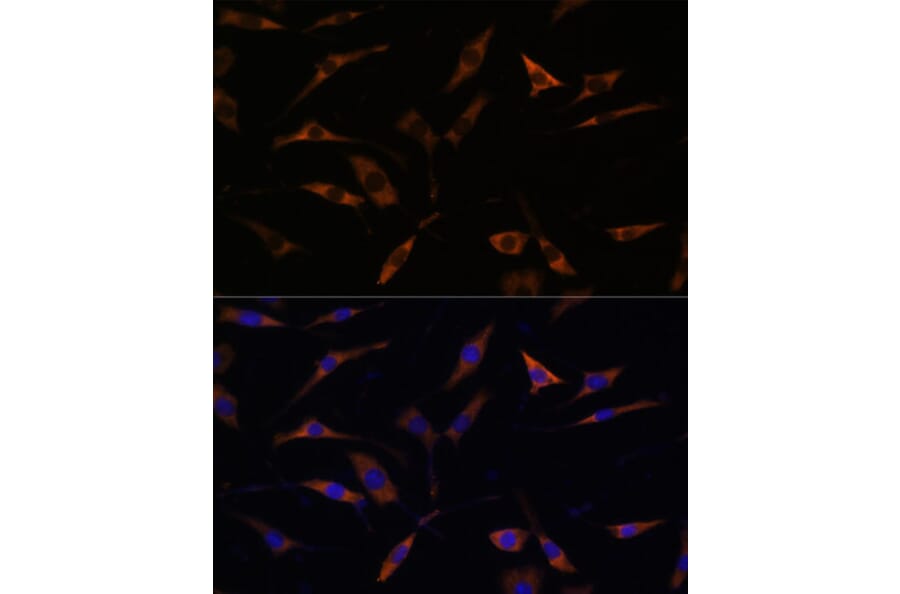 Immunofluorescence - Anti-RPL28 Antibody (A88442) - Antibodies.com