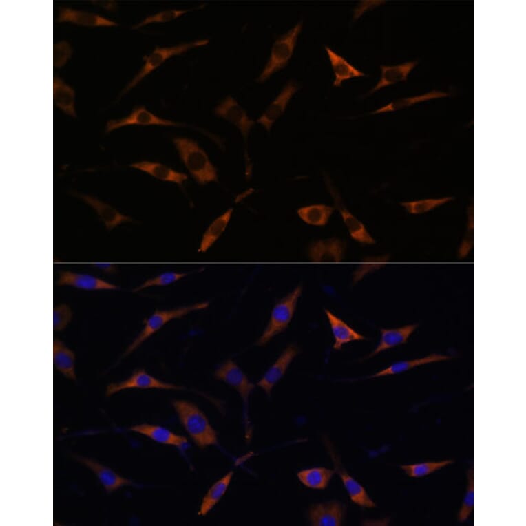 Immunofluorescence - Anti-RPL28 Antibody (A88442) - Antibodies.com