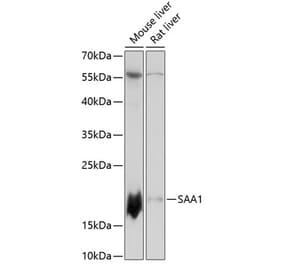Western Blot - Anti-Serum Amyloid A Antibody (A88443) - Antibodies.com