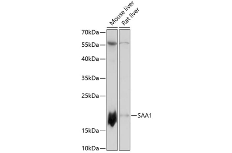 Western Blot - Anti-Serum Amyloid A Antibody (A88443) - Antibodies.com