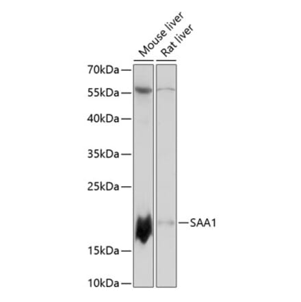 Western Blot - Anti-Serum Amyloid A Antibody (A88443) - Antibodies.com